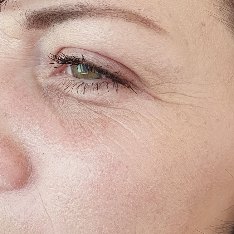 Close-up of a person's eye with visible wrinkles on the skin