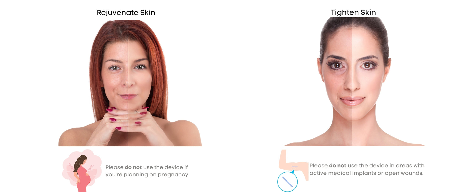 Before and after comparison of skin rejuvenation 